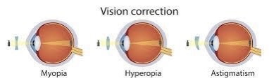correcion optica